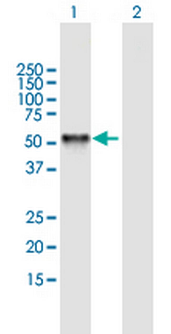 RING1 Antibody in Western Blot (WB)