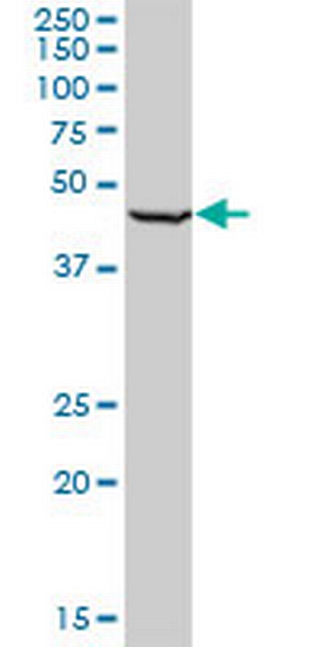 RING1 Antibody in Western Blot (WB)