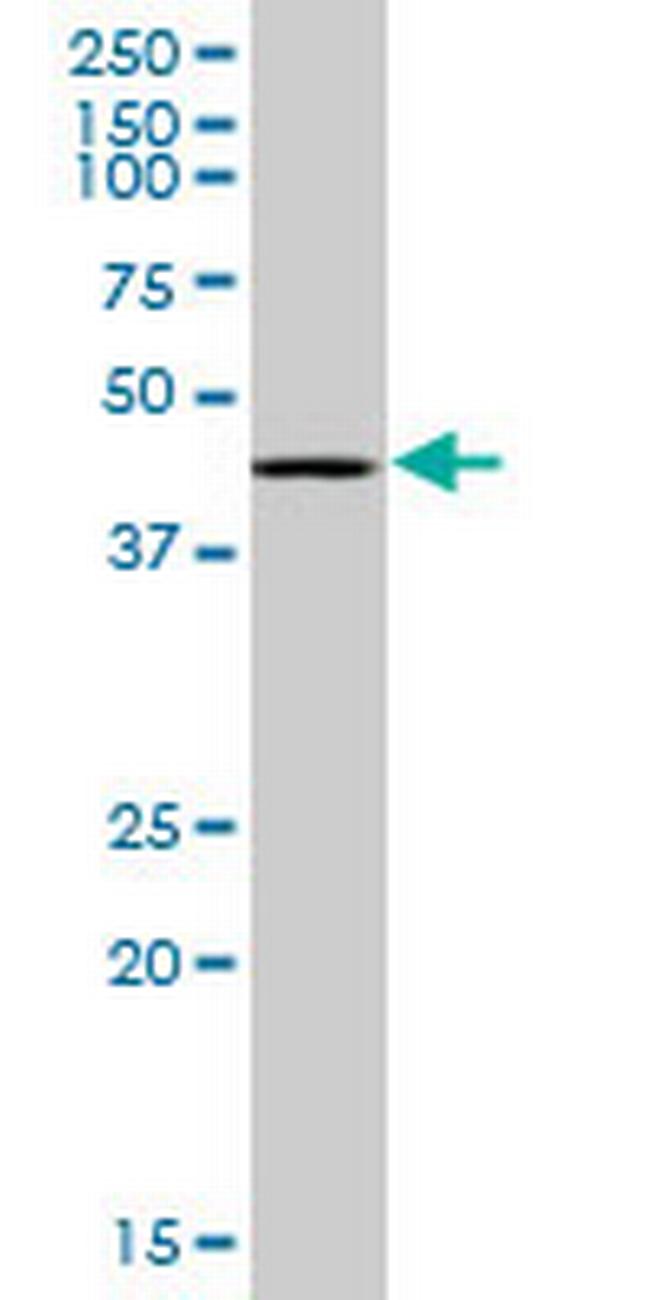 RING1 Antibody in Western Blot (WB)