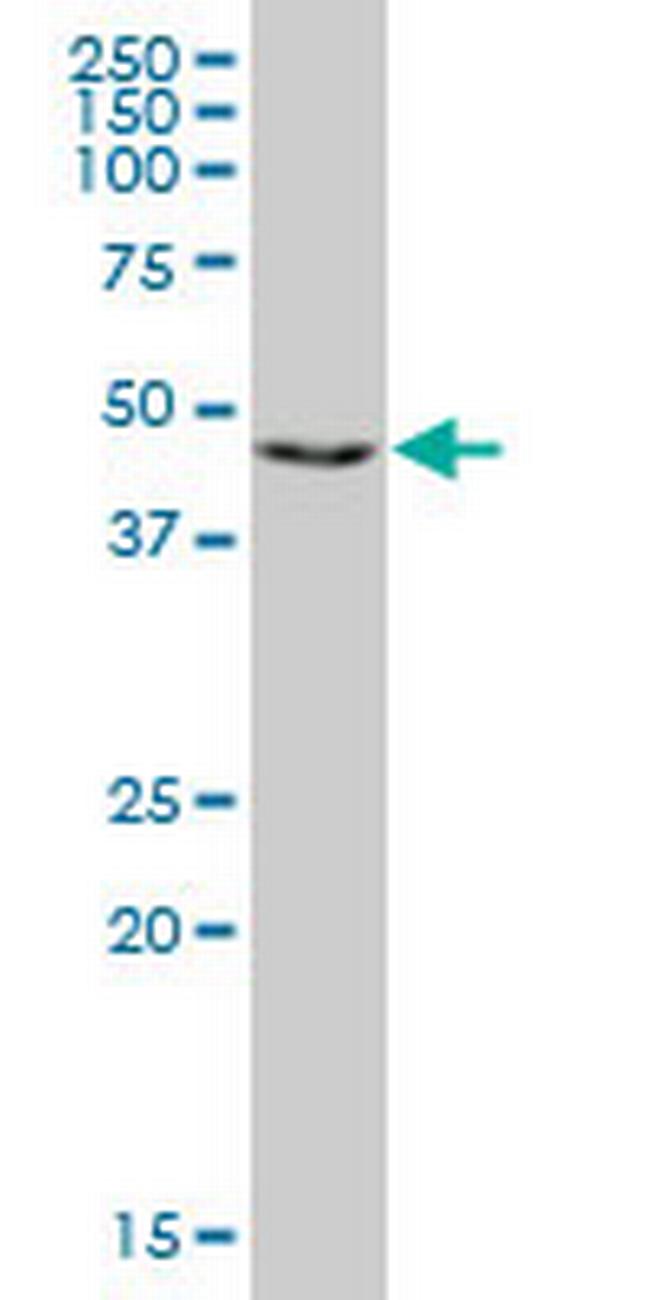 RING1 Antibody in Western Blot (WB)