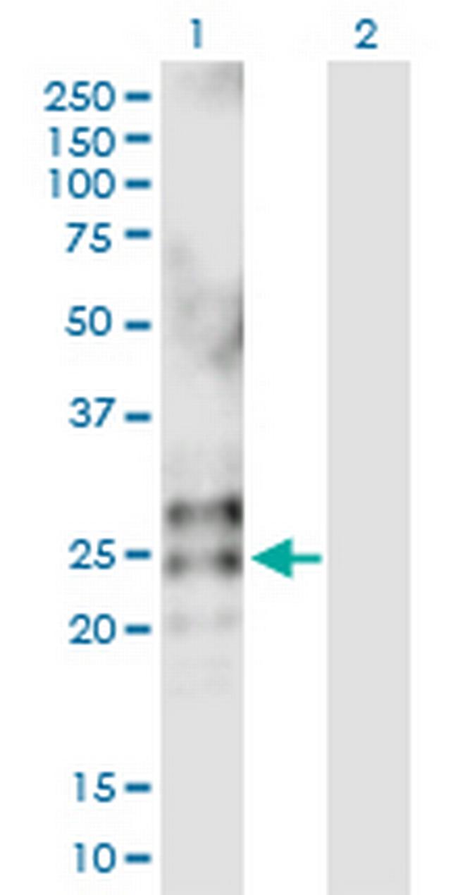 RNASE2 Antibody in Western Blot (WB)
