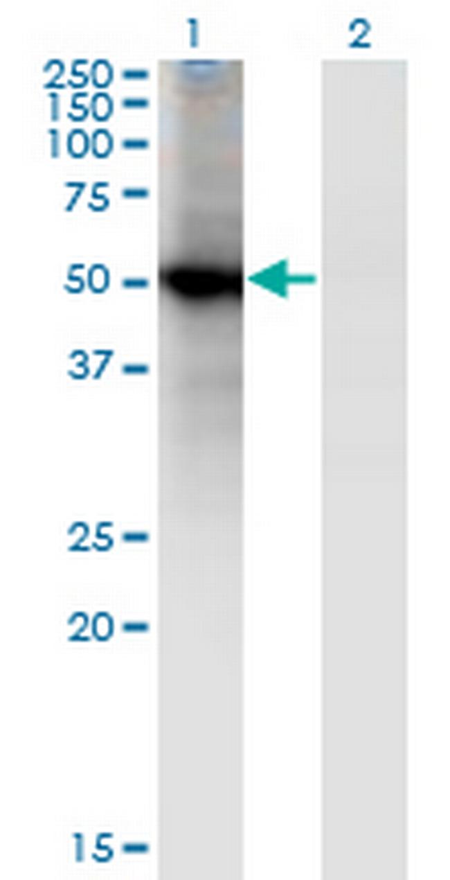 RORB Antibody in Western Blot (WB)