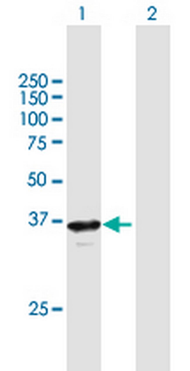 RP2 Antibody in Western Blot (WB)