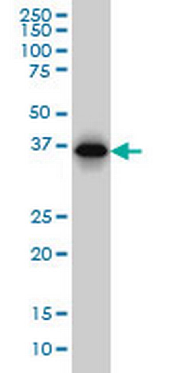 RP2 Antibody in Western Blot (WB)