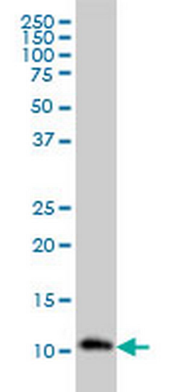 RPA3 Antibody in Western Blot (WB)