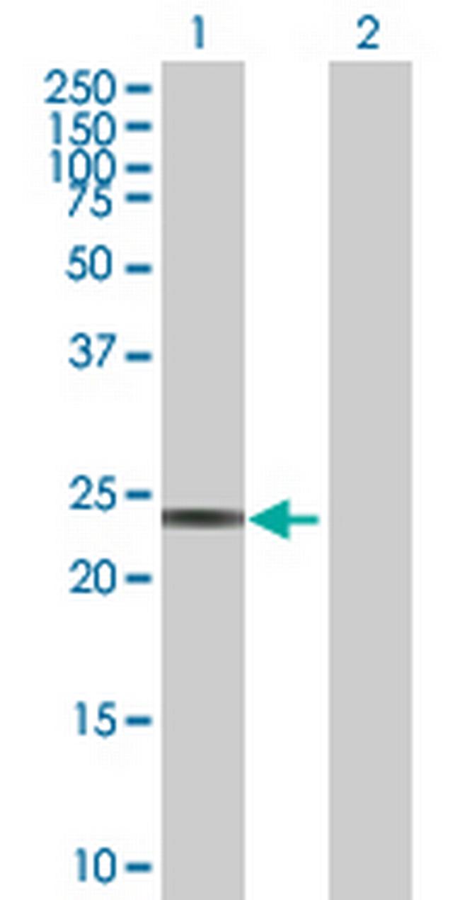 RPE Antibody in Western Blot (WB)