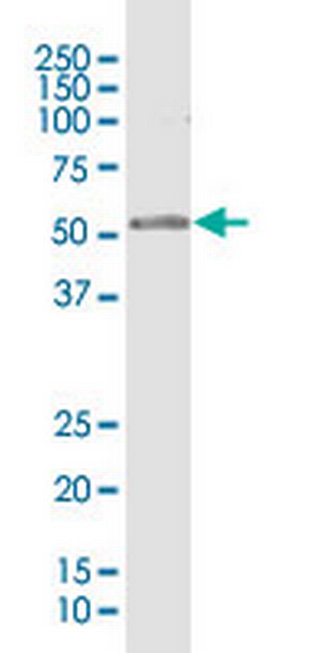 RPL4 Antibody in Western Blot (WB)
