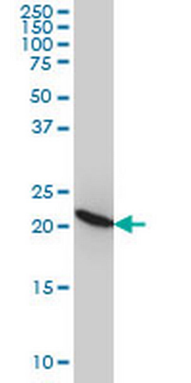 RPL9 Antibody in Western Blot (WB)