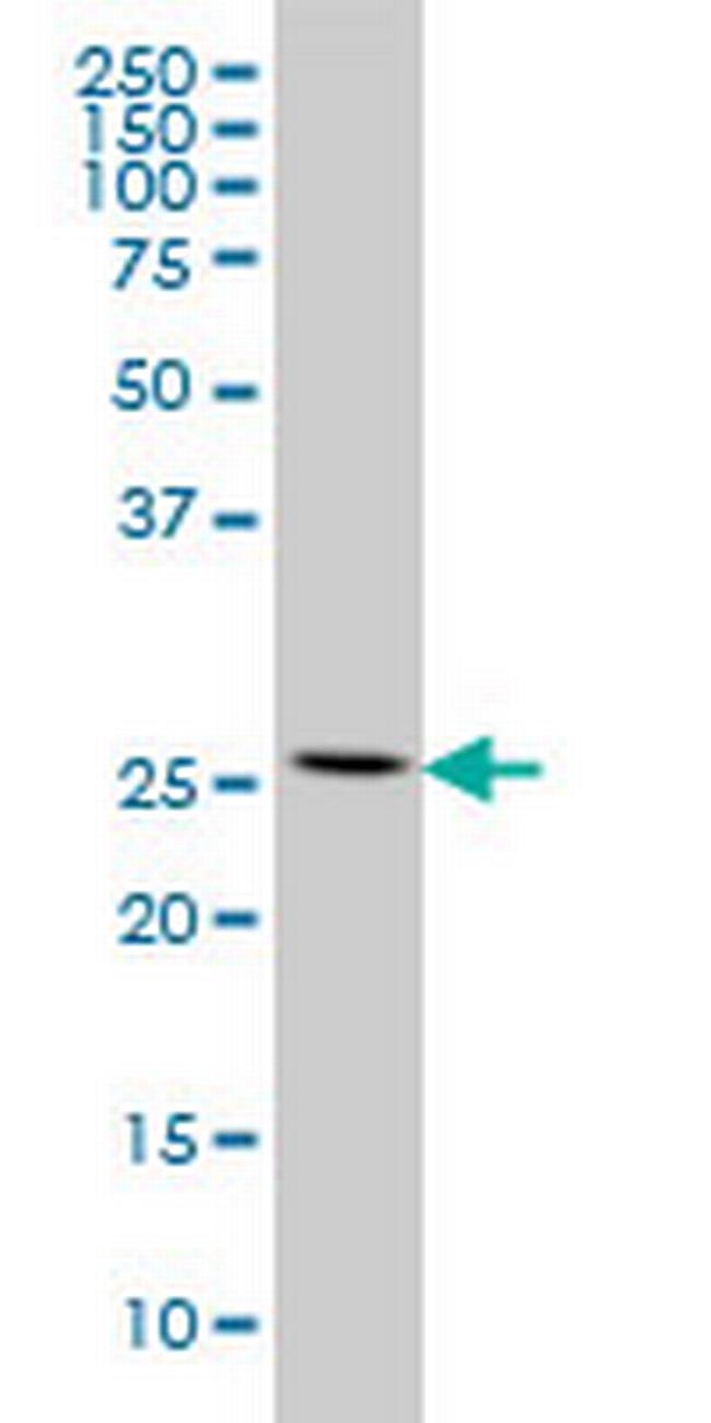 RPL13 Antibody in Western Blot (WB)
