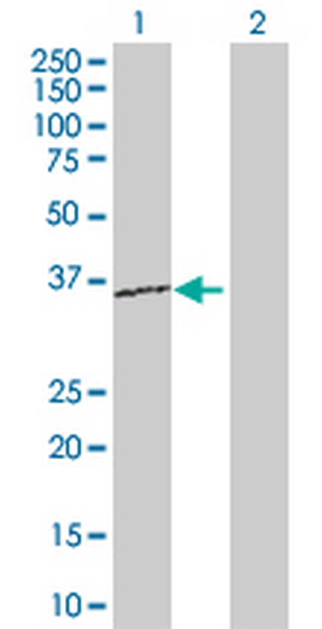 RPL15 Antibody in Western Blot (WB)