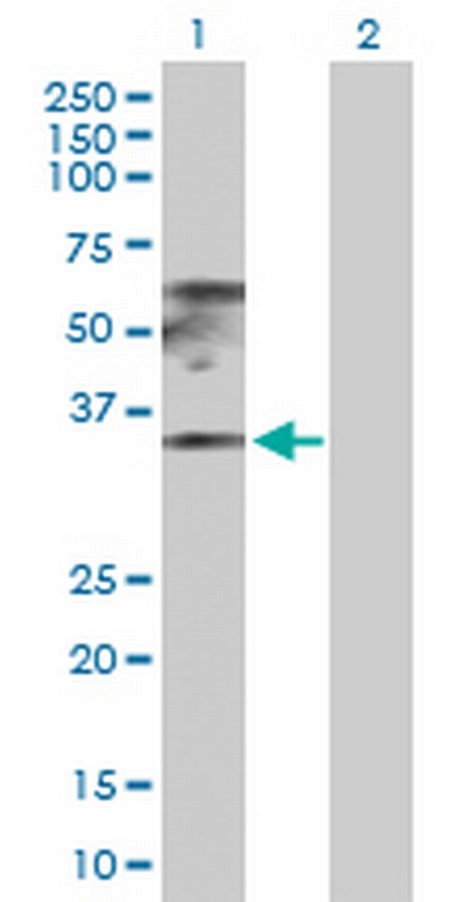 RPL17 Antibody in Western Blot (WB)