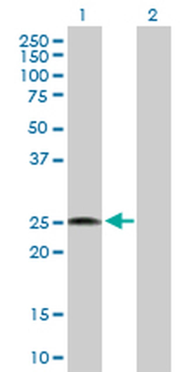 RPL18 Antibody in Western Blot (WB)