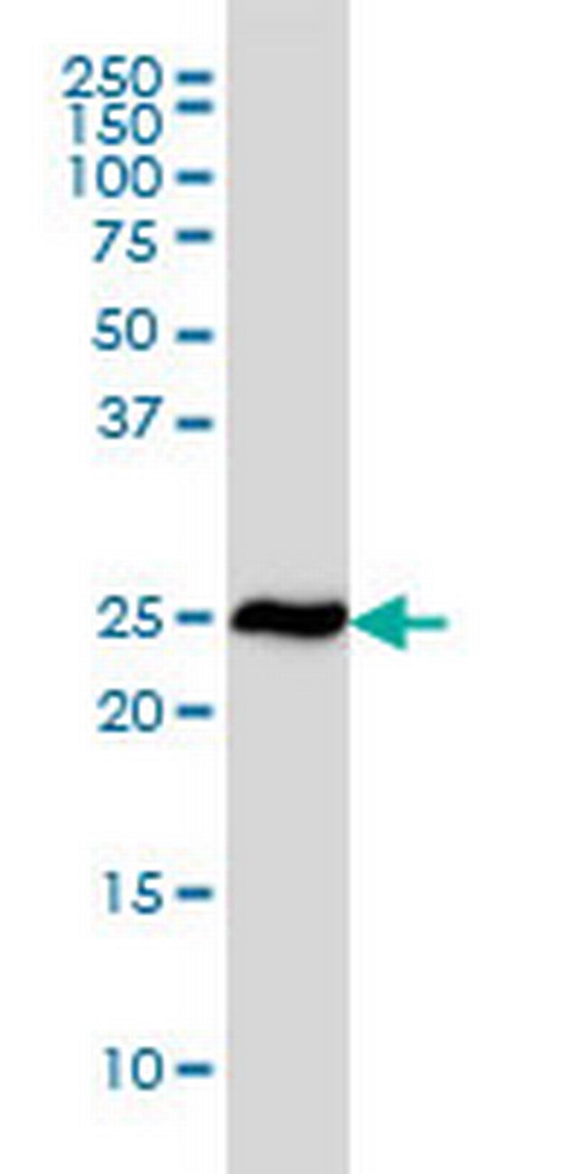 RPL19 Antibody in Western Blot (WB)