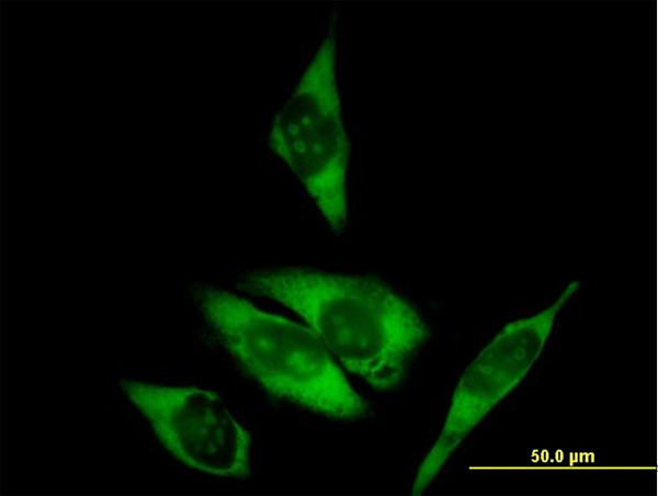 RPL29 Antibody in Immunocytochemistry (ICC/IF)