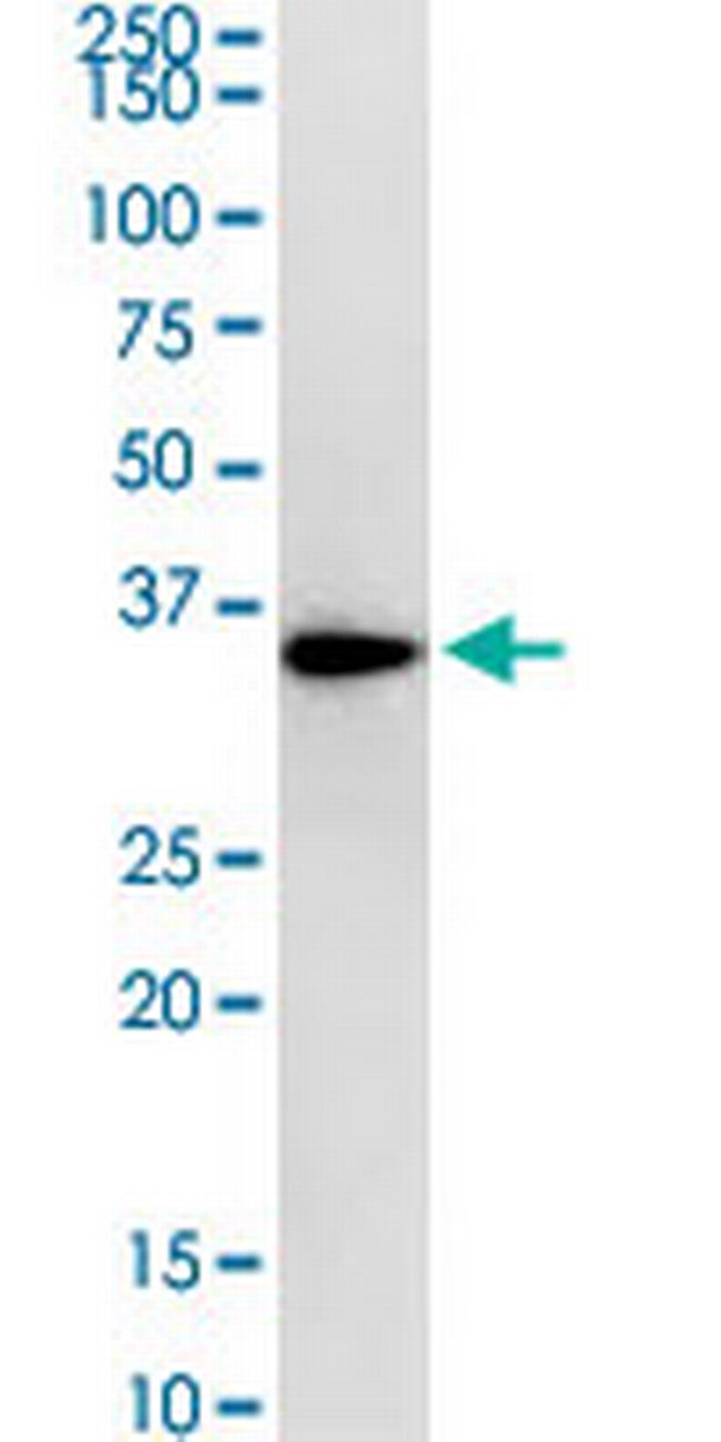 RPLP0 Antibody in Western Blot (WB)