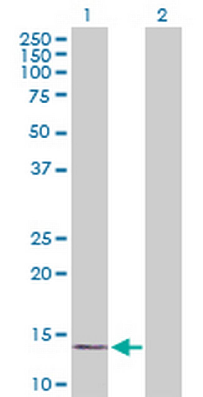 RPLP1 Antibody in Western Blot (WB)
