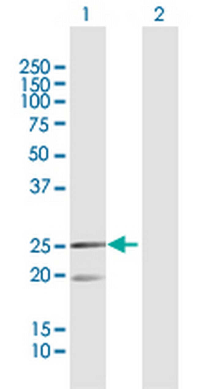 MRPL12 Antibody in Western Blot (WB)