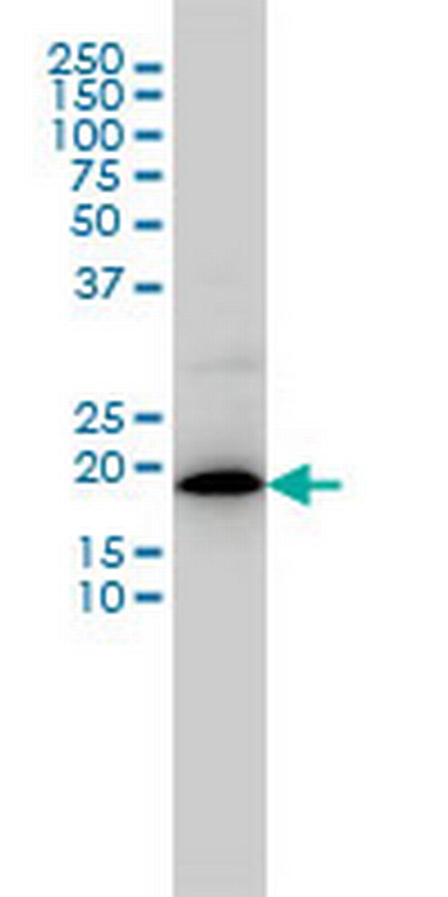 MRPL12 Antibody in Western Blot (WB)