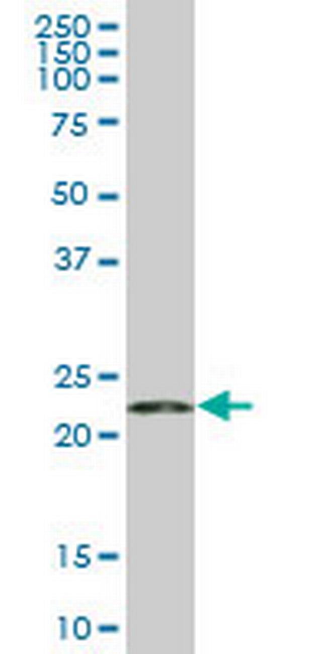 RPS5 Antibody in Western Blot (WB)
