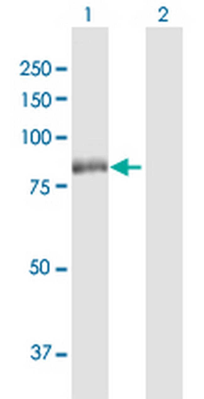 RPS6KA2 Antibody in Western Blot (WB)