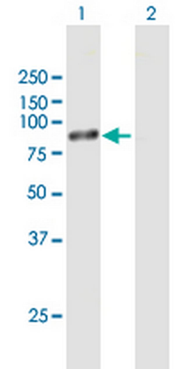 RPS6KB1 Antibody in Western Blot (WB)