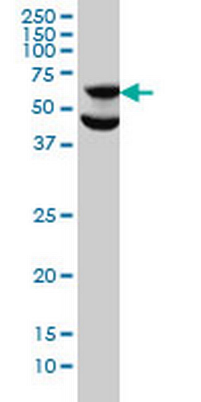 RPS6KB1 Antibody in Western Blot (WB)