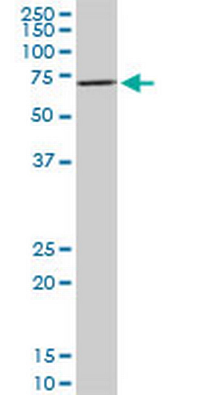 RPS6KB1 Antibody in Western Blot (WB)