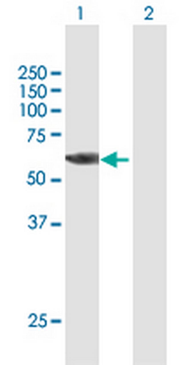 RPS6KB2 Antibody in Western Blot (WB)