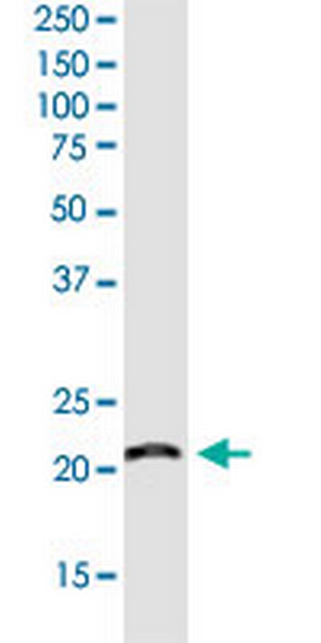 RPS7 Antibody in Western Blot (WB)