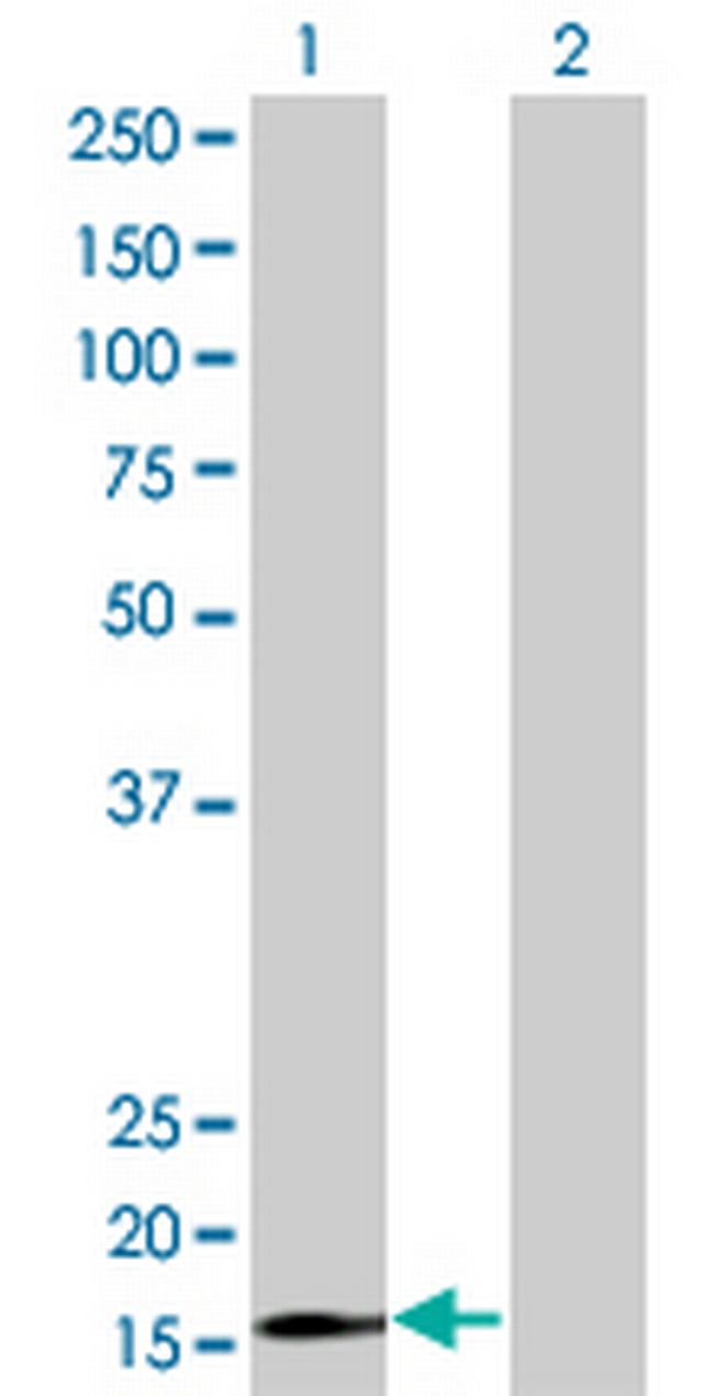 RPS15 Antibody in Western Blot (WB)