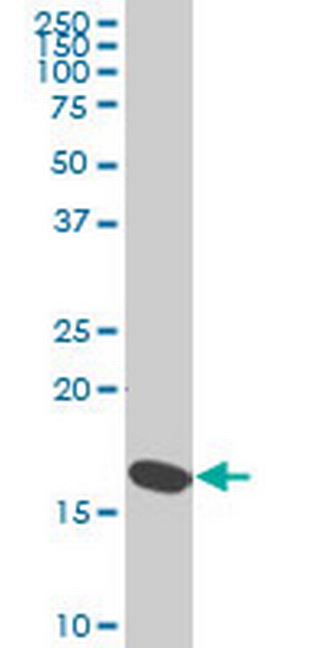 RPS23 Antibody in Western Blot (WB)