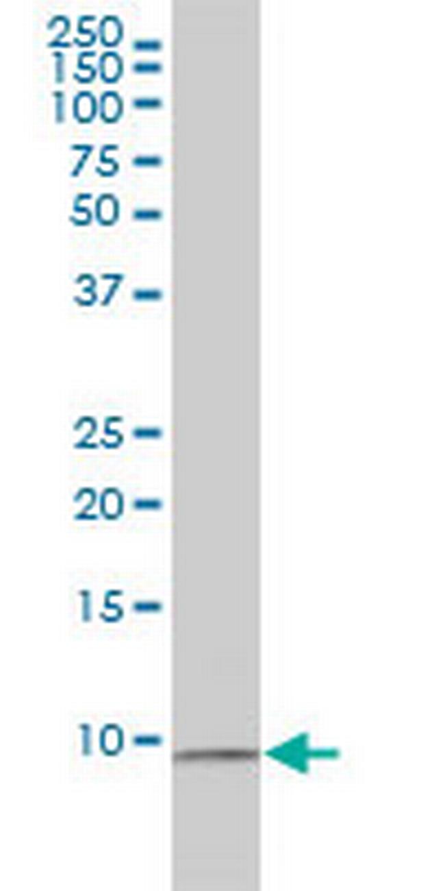 RPS27A Antibody in Western Blot (WB)
