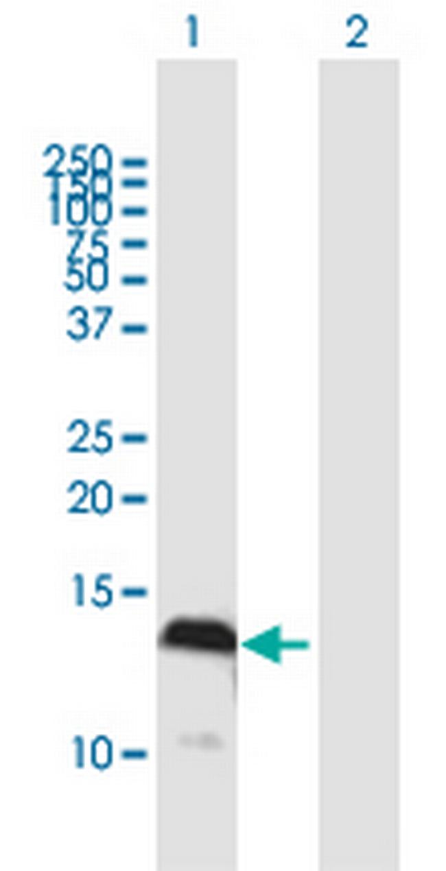 S100A4 Antibody in Western Blot (WB)