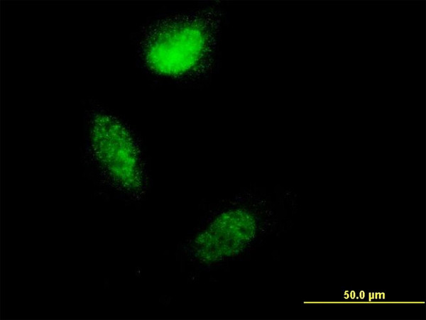 S100A4 Antibody in Immunocytochemistry (ICC/IF)