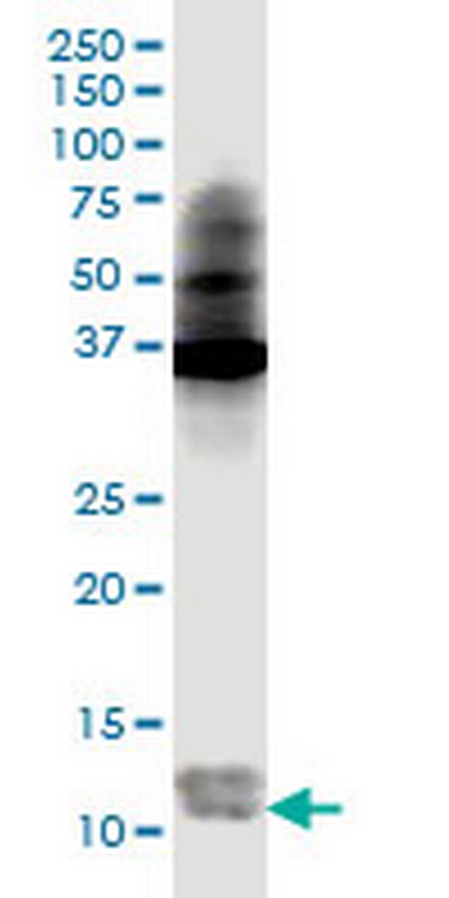 S100A4 Antibody in Western Blot (WB)