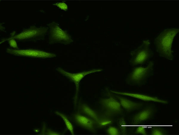 S100A7 Antibody in Immunocytochemistry (ICC/IF)