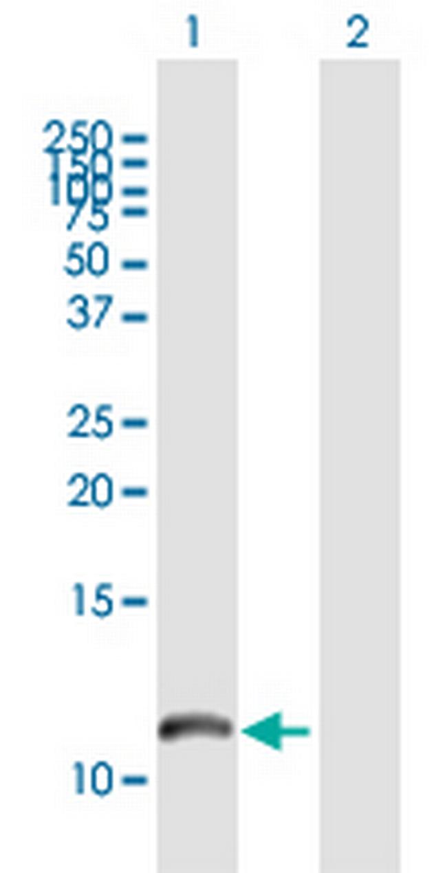 S100A8 Antibody in Western Blot (WB)