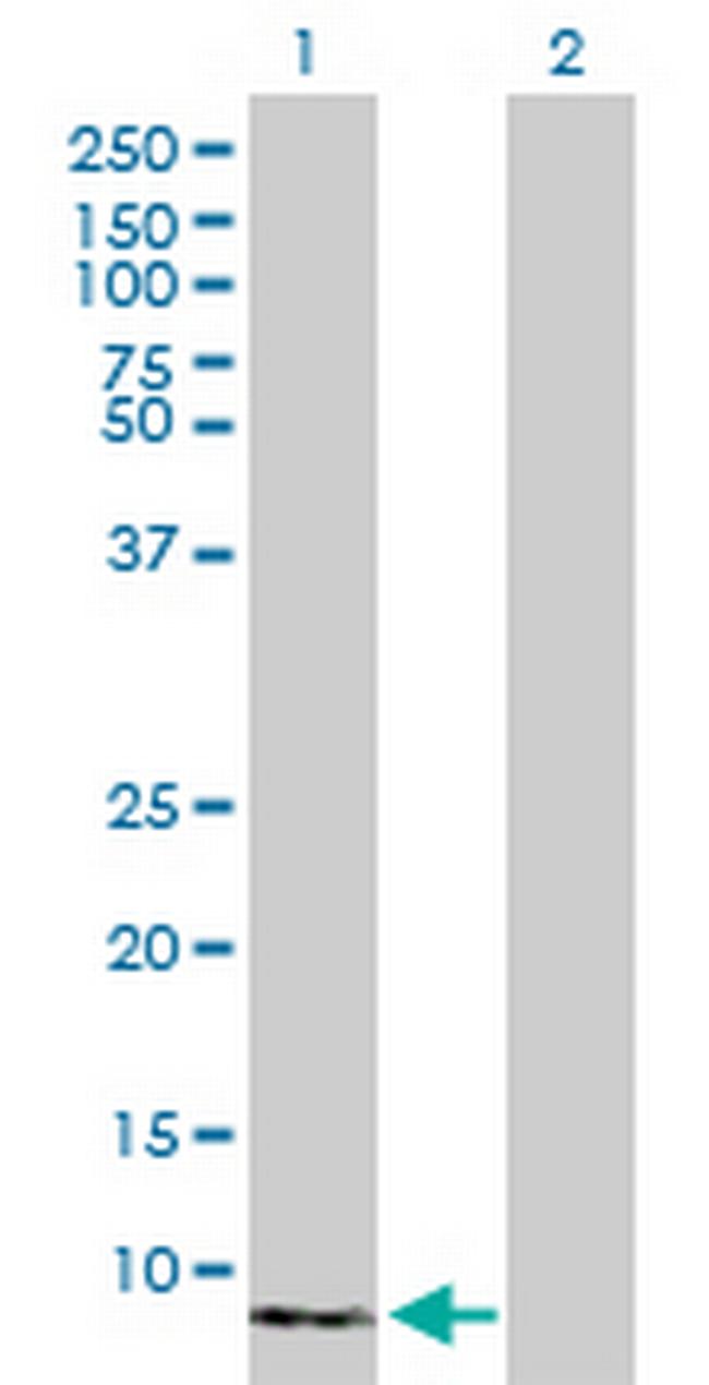 S100A8 Antibody in Western Blot (WB)