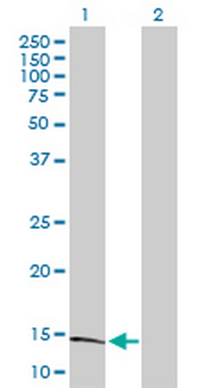 S100A9 Antibody in Western Blot (WB)