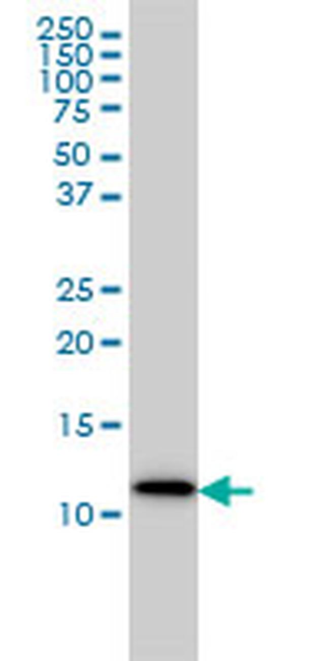 S100A9 Antibody in Western Blot (WB)