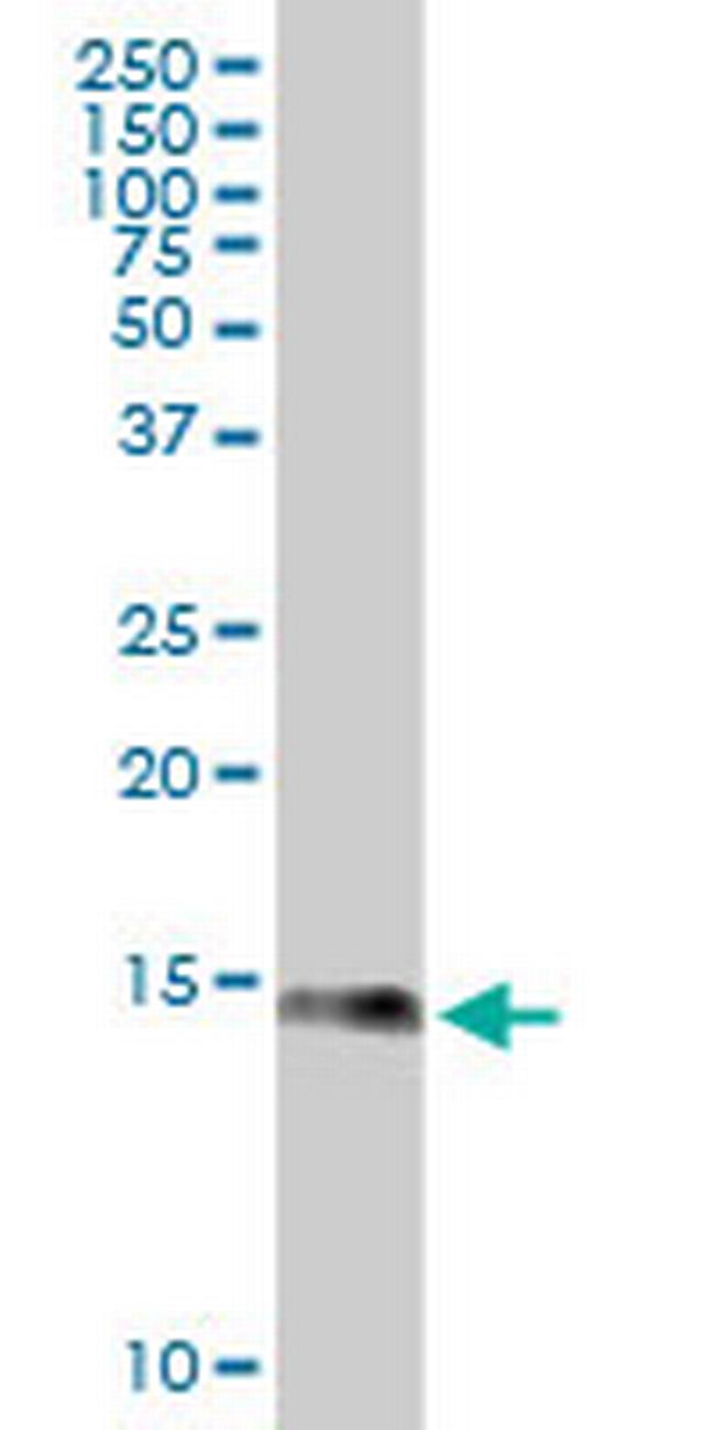 S100A9 Antibody in Western Blot (WB)