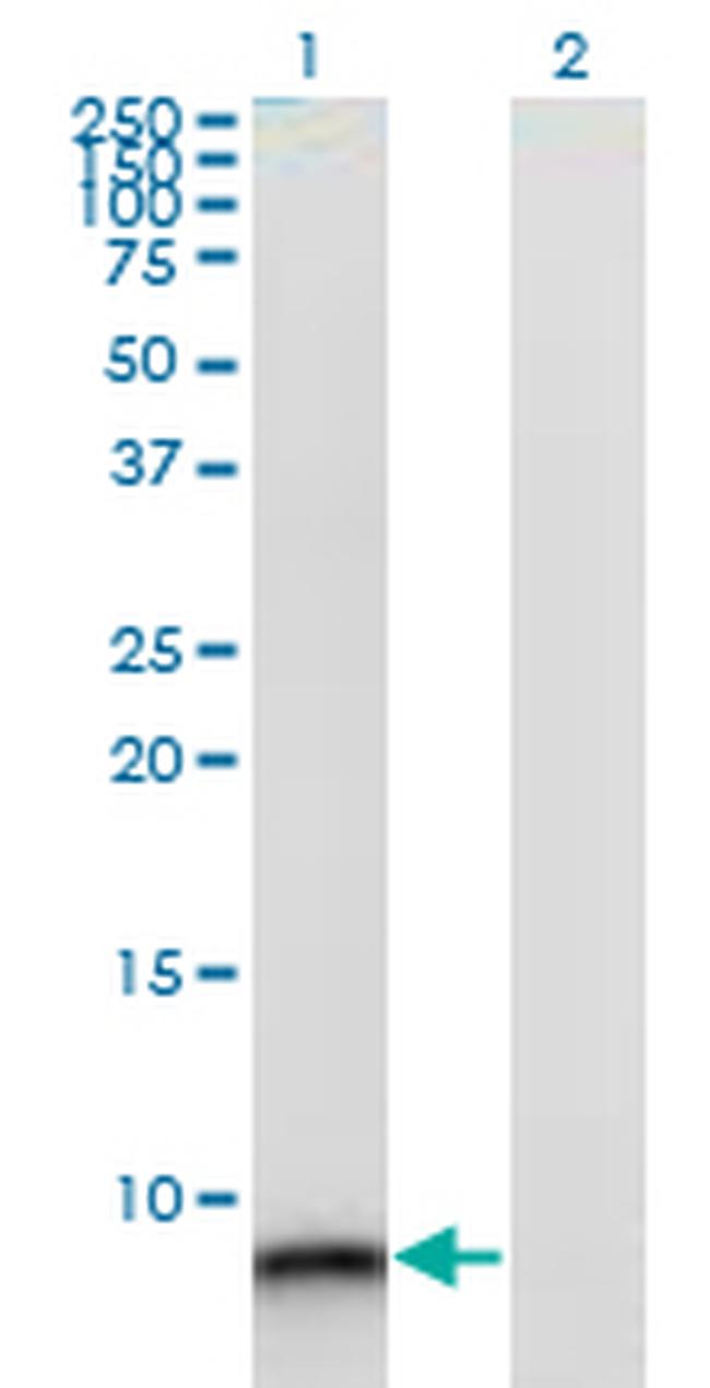 S100A12 Antibody in Western Blot (WB)