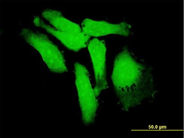 S100P Antibody in Immunocytochemistry (ICC/IF)