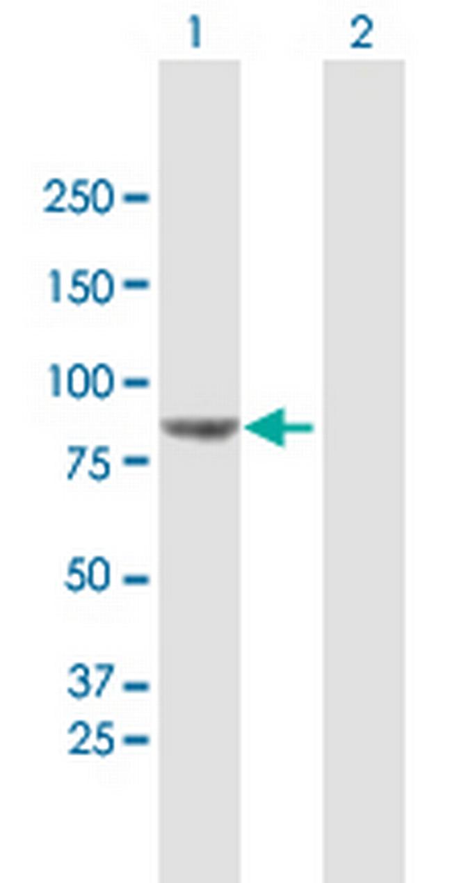 VPS52 Antibody in Western Blot (WB)