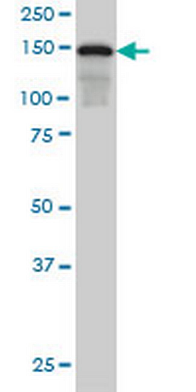 SAFB Antibody in Western Blot (WB)