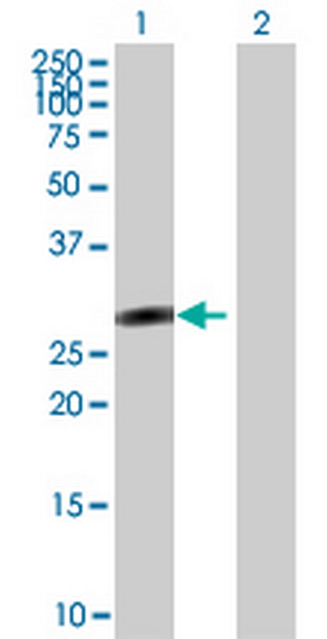 SALL2 Antibody in Western Blot (WB)