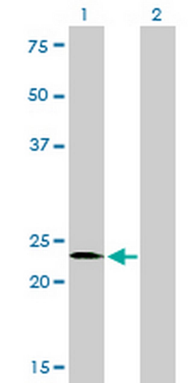 SALL2 Antibody in Western Blot (WB)