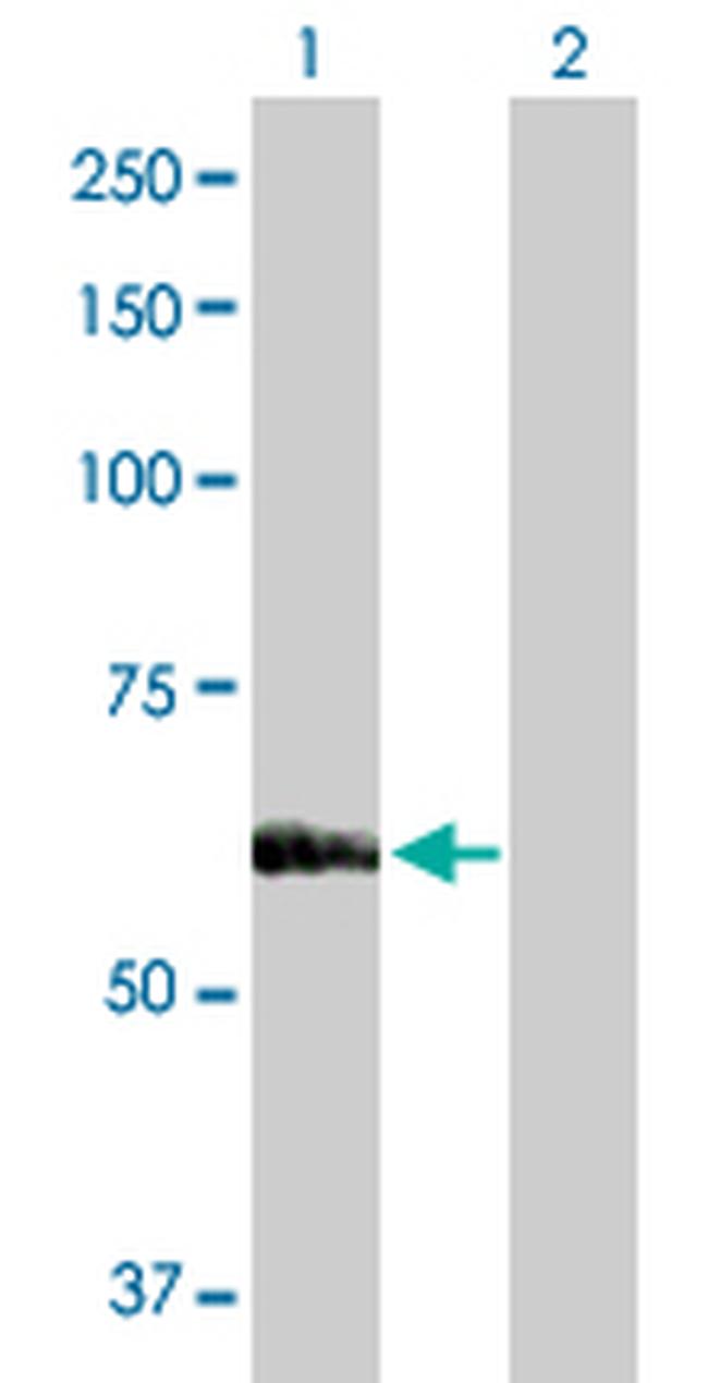 SARS Antibody in Western Blot (WB)
