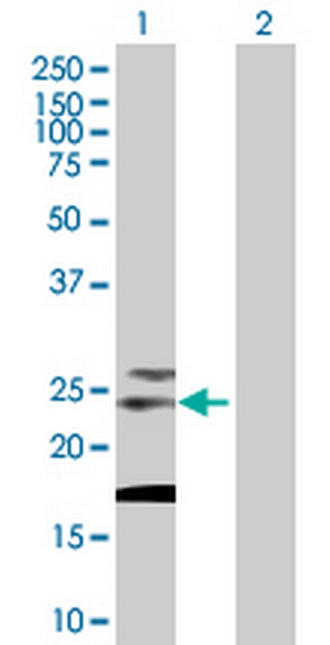 TSPAN31 Antibody in Western Blot (WB)