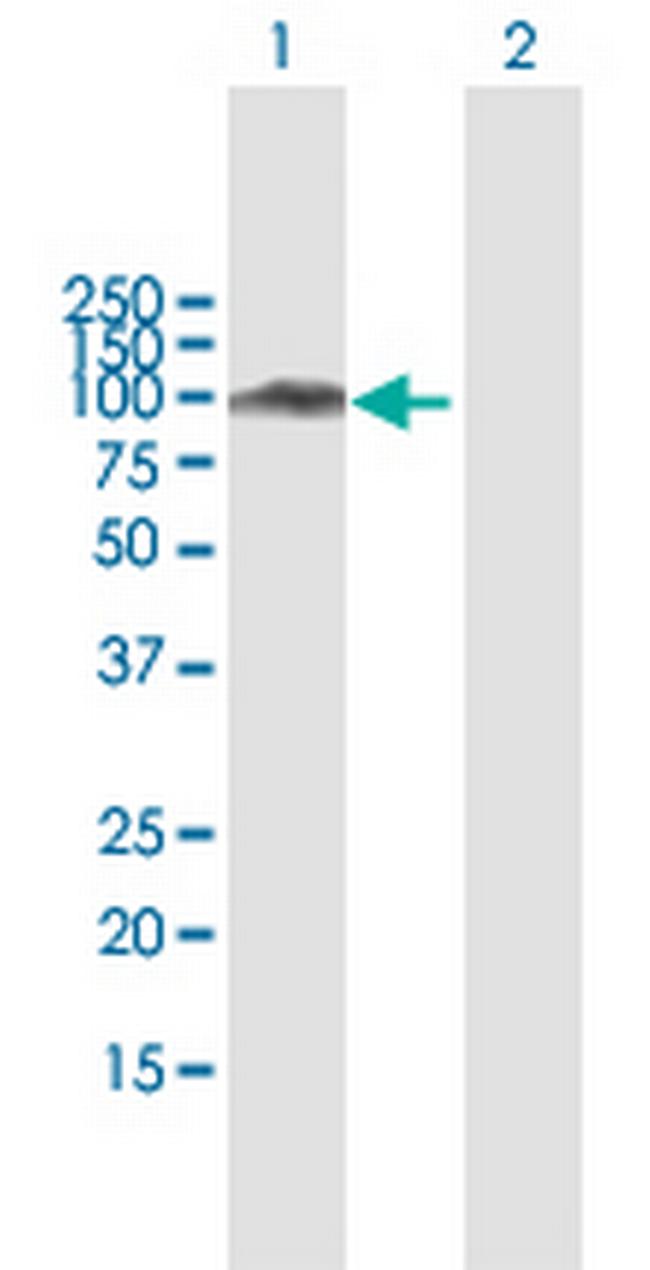 SATB1 Antibody in Western Blot (WB)